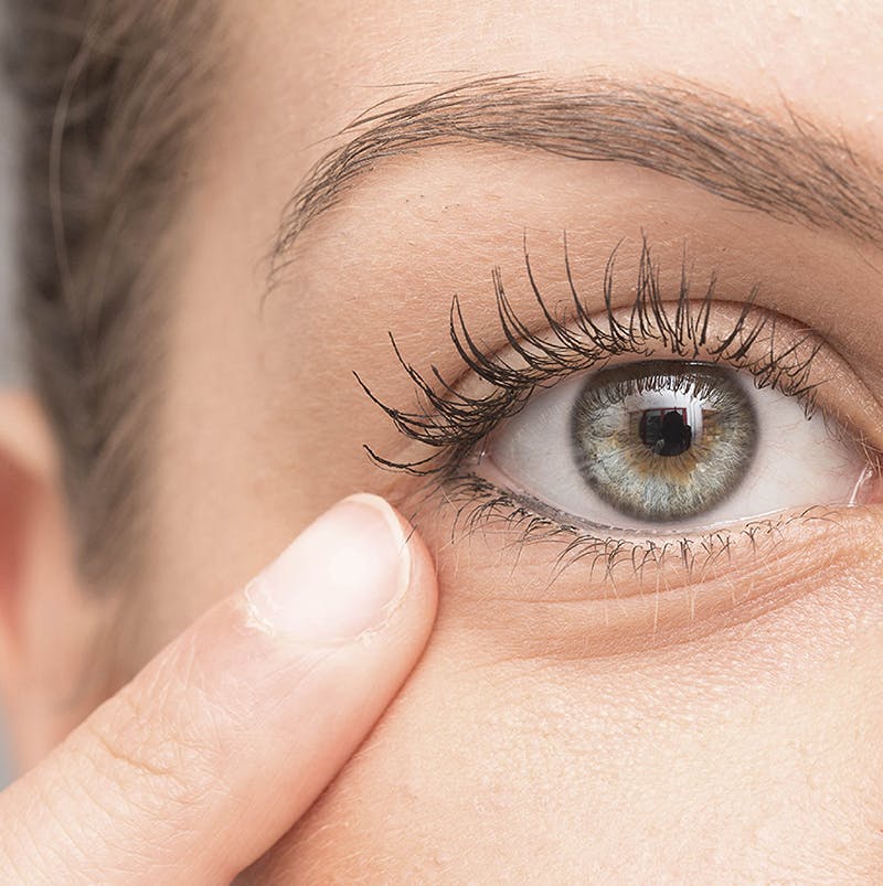 women showing blepharitis | Centers for dry eye
