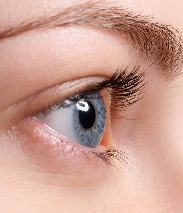 women with Root Cause | centers for dry eye
